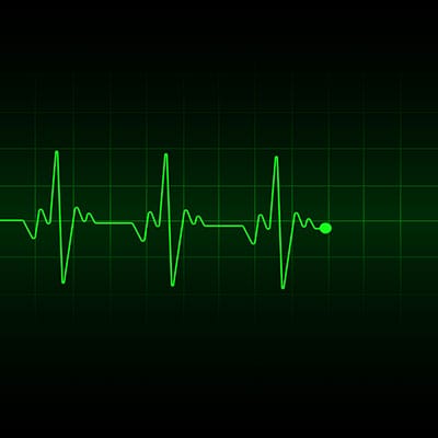 Beat frequency oscillator